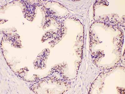 2 - Anti-GAA Picoband Antibody ABO10192