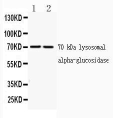 1 - Anti-GAA Picoband Antibody ABO10192