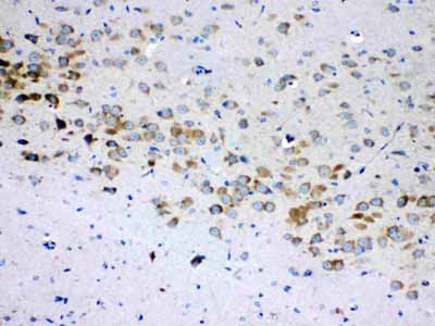 2 - Anti-RPS6 Picoband Antibody ABO10194