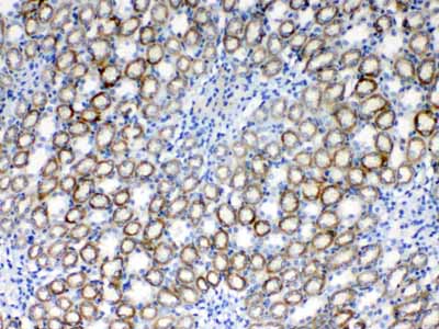 2 - Anti-RPS6 Picoband Antibody ABO10194