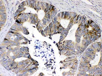 2 - Anti-RPS6 Picoband Antibody ABO10194