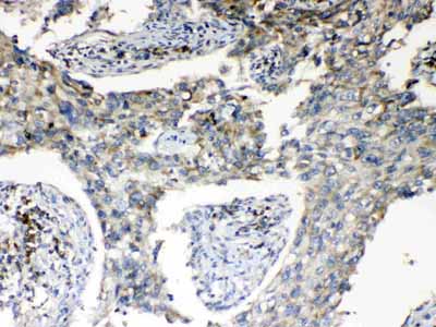 2 - Anti-RPS6 Picoband Antibody ABO10194