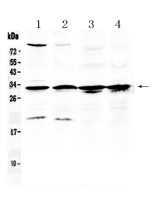 1 - Anti-RPS6 Picoband Antibody ABO10194