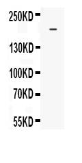 1 - Anti-MRP4 Picoband Antibody ABO10198