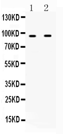 1 - Anti-IFNGR1 Picoband Antibody ABO10207