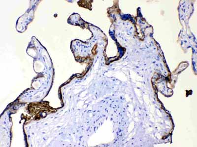 2 - Anti-ALPP Picoband Antibody ABO10209
