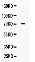 1 - Anti-ALPP Picoband Antibody ABO10209