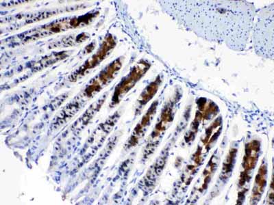 2 - Anti-CD166/ALCAM Picoband Antibody ABO10213