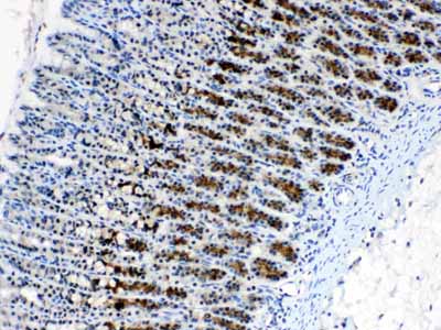 2 - Anti-CD166/ALCAM Picoband Antibody ABO10213