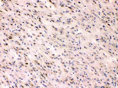 2 - Anti-Beta III Tubulin Picoband Antibody ABO10218