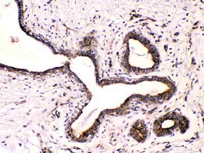2 - Anti-Beta III Tubulin Picoband Antibody ABO10218