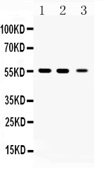 1 - Anti-Beta III Tubulin Picoband Antibody ABO10218