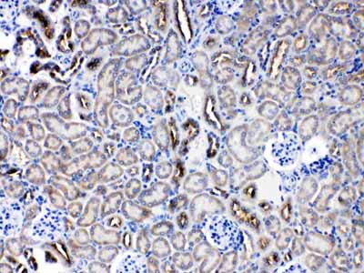 2 - Anti-SERPINA5 Picoband Antibody ABO10220