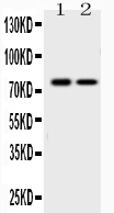 1 - Anti-GAB1 Picoband Antibody ABO10222
