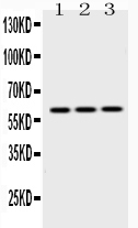1 - Anti-EPHX2 Picoband Antibody ABO10225