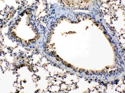2 - Anti-Periplakin Picoband Antibody ABO10228