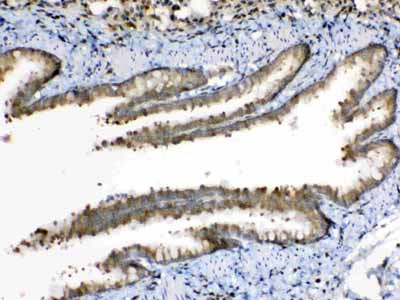 2 - Anti-Periplakin Picoband Antibody ABO10228