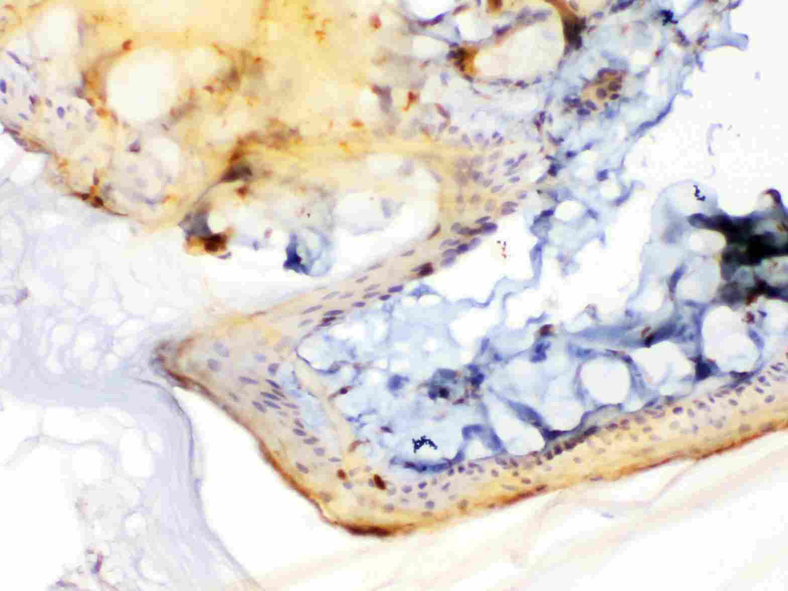 2 - Anti-Periplakin Picoband Antibody ABO10228