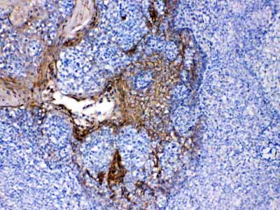 2 - Anti-Periplakin Picoband Antibody ABO10228