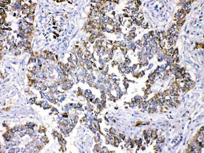 2 - Anti-Periplakin Picoband Antibody ABO10228