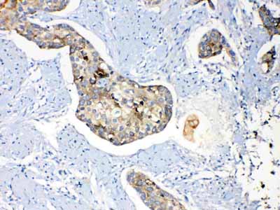 2 - Anti-Periplakin Picoband Antibody ABO10228