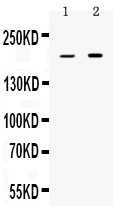 1 - Anti-Periplakin Picoband Antibody ABO10228