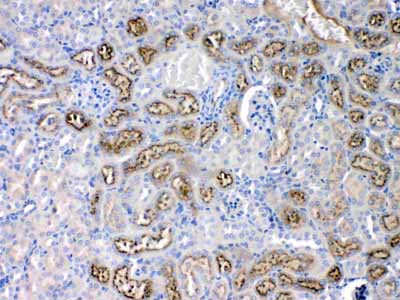 2 - Anti-Angiotensinogen Picoband Antibody ABO10229