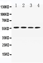 1 - Anti-Angiotensinogen Picoband Antibody ABO10229