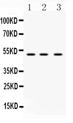 1 - Anti-DR4 Picoband Antibody ABO10230