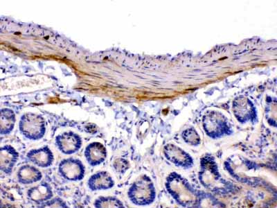 2 - Anti-CHRNA5 Picoband Antibody ABO10244