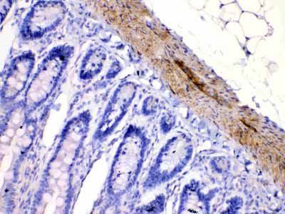 2 - Anti-CHRNA5 Picoband Antibody ABO10244