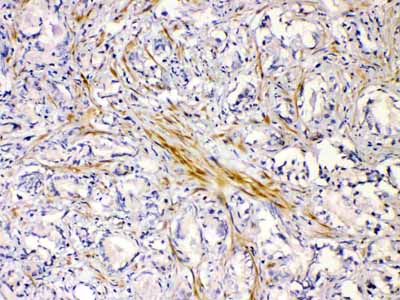 2 - Anti-CHRNA5 Picoband Antibody ABO10244