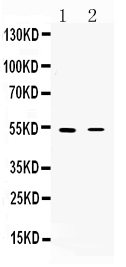 1 - Anti-CHRNA5 Picoband Antibody ABO10244