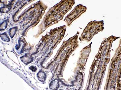 2 - Anti-FABP2/I-FABP Picoband Antibody ABO10245