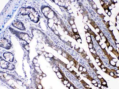 2 - Anti-FABP2/I-FABP Picoband Antibody ABO10245