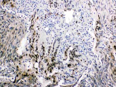 2 - Anti-FABP2/I-FABP Picoband Antibody ABO10245