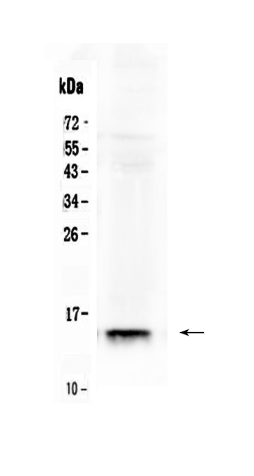 1 - Anti-FABP2/I-FABP Picoband Antibody ABO10245