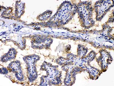 2 - Anti-PDE5A Picoband Antibody ABO10250