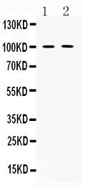 1 - Anti-PDE5A Picoband Antibody ABO10250