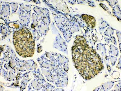 2 - Anti-HSPB8/Hsp22 Picoband Antibody ABO10251
