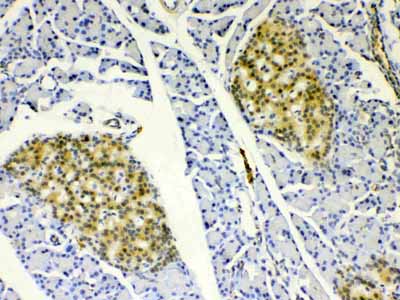 2 - Anti-HSPB8/Hsp22 Picoband Antibody ABO10251