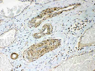 2 - Anti-HSPB8/Hsp22 Picoband Antibody ABO10251