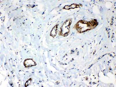 2 - Anti-HSPB8/Hsp22 Picoband Antibody ABO10251