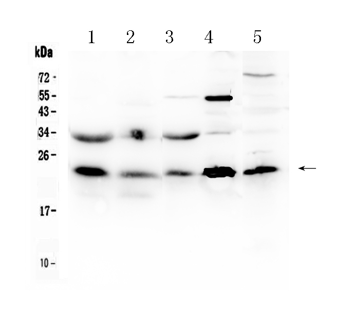 1 - Anti-HSPB8/Hsp22 Picoband Antibody ABO10251