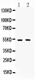 1 - Anti-CHRM2 Picoband Antibody ABO10256