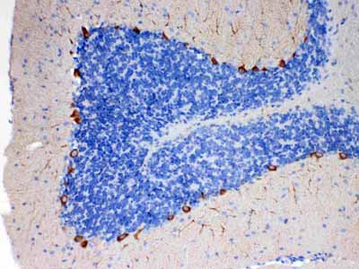 2 - Anti-EBP1 Picoband Antibody ABO10259