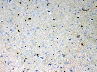 2 - Anti-HCN2 Picoband Antibody ABO10260