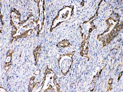 2 - Anti-TECTA Picoband Antibody ABO10262