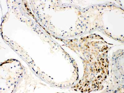 2 - Anti-TECTA Picoband Antibody ABO10262