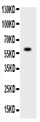 1 - Anti-ADAMTS4 Picoband Antibody ABO10265